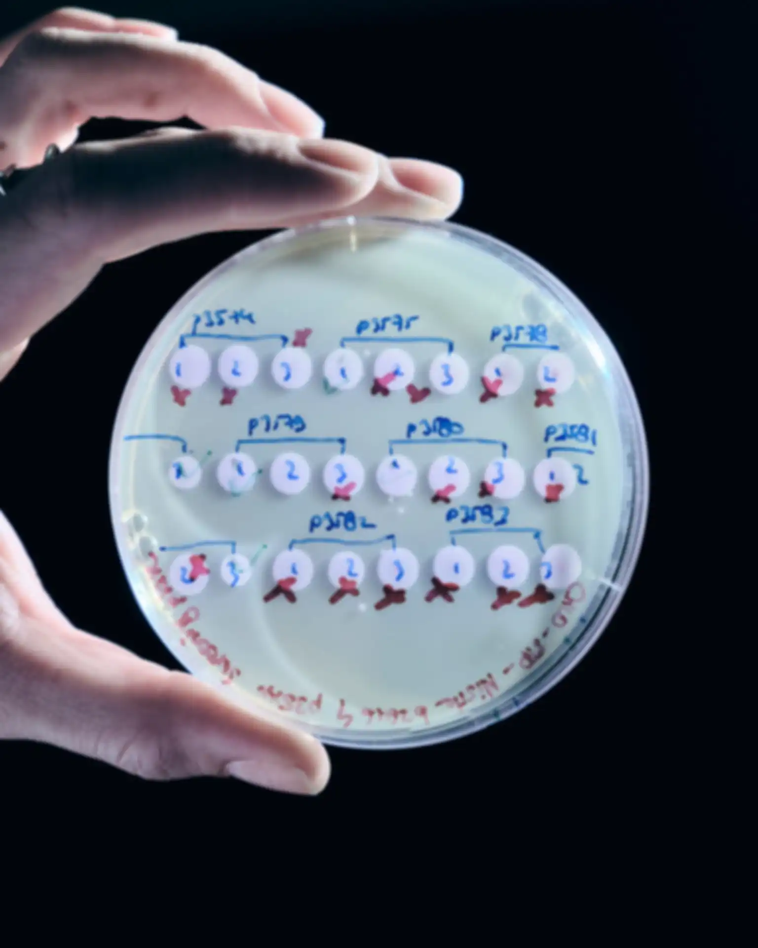A hand holds a labeled Petri dish against a dark background