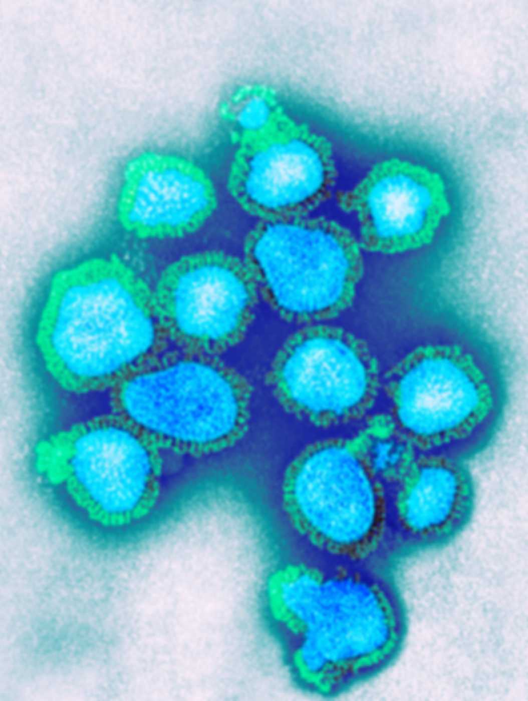 Virus